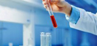 Angola recebe reagentes para 50 mil testes